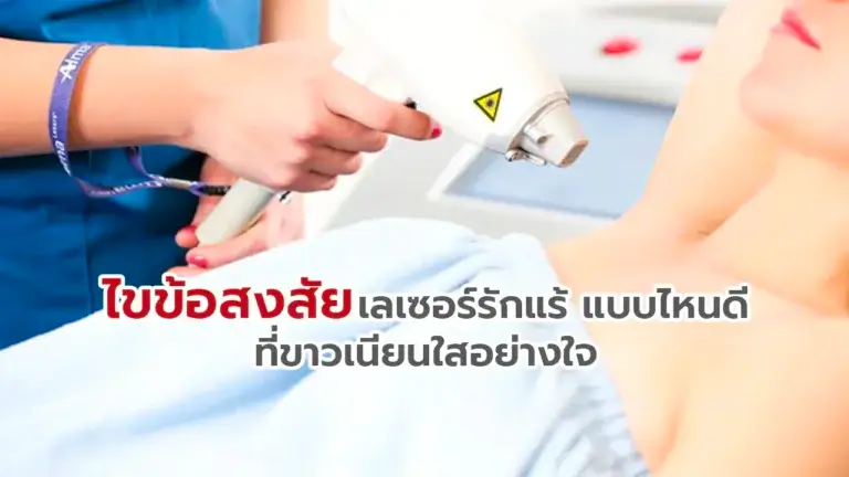 ไขข้อสงสัยเลเซอร์รักแร้ แบบไหนดี ที่ขาวเนียนใสอย่างใจ