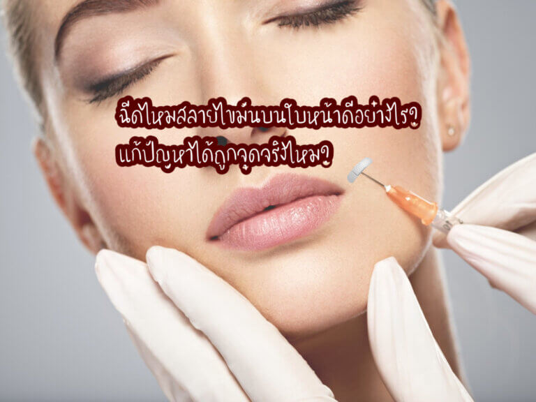 ฉีดไหมสลายไขมันบนใบหน้า