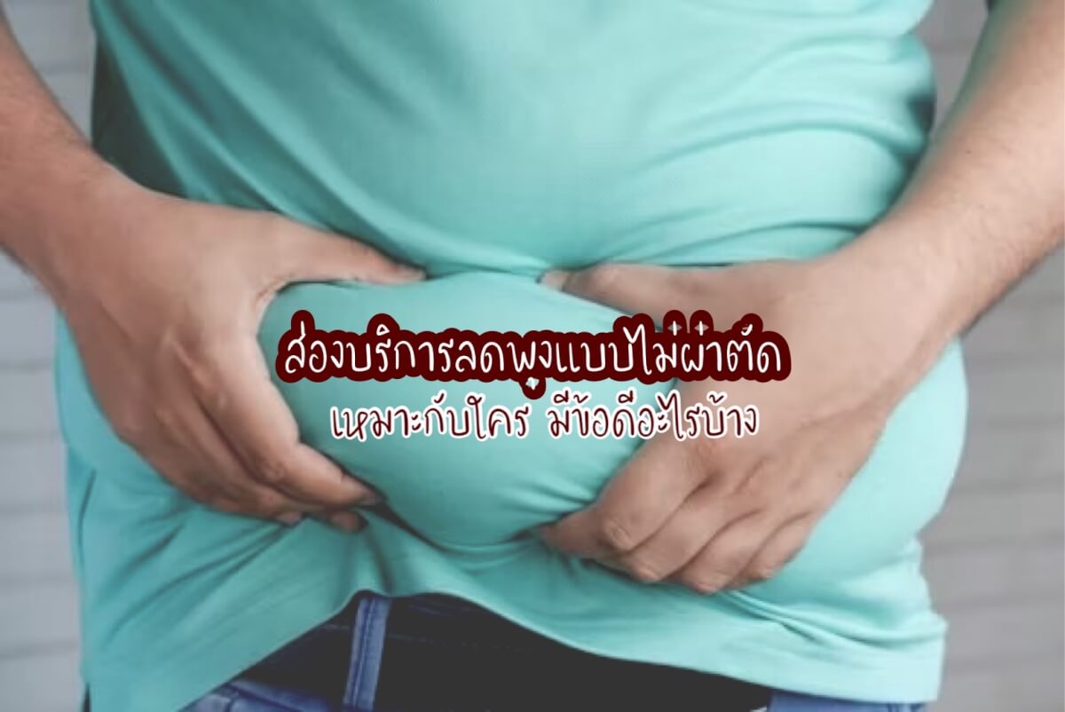 ลดพุงแบบไม่ผ่าตัด
