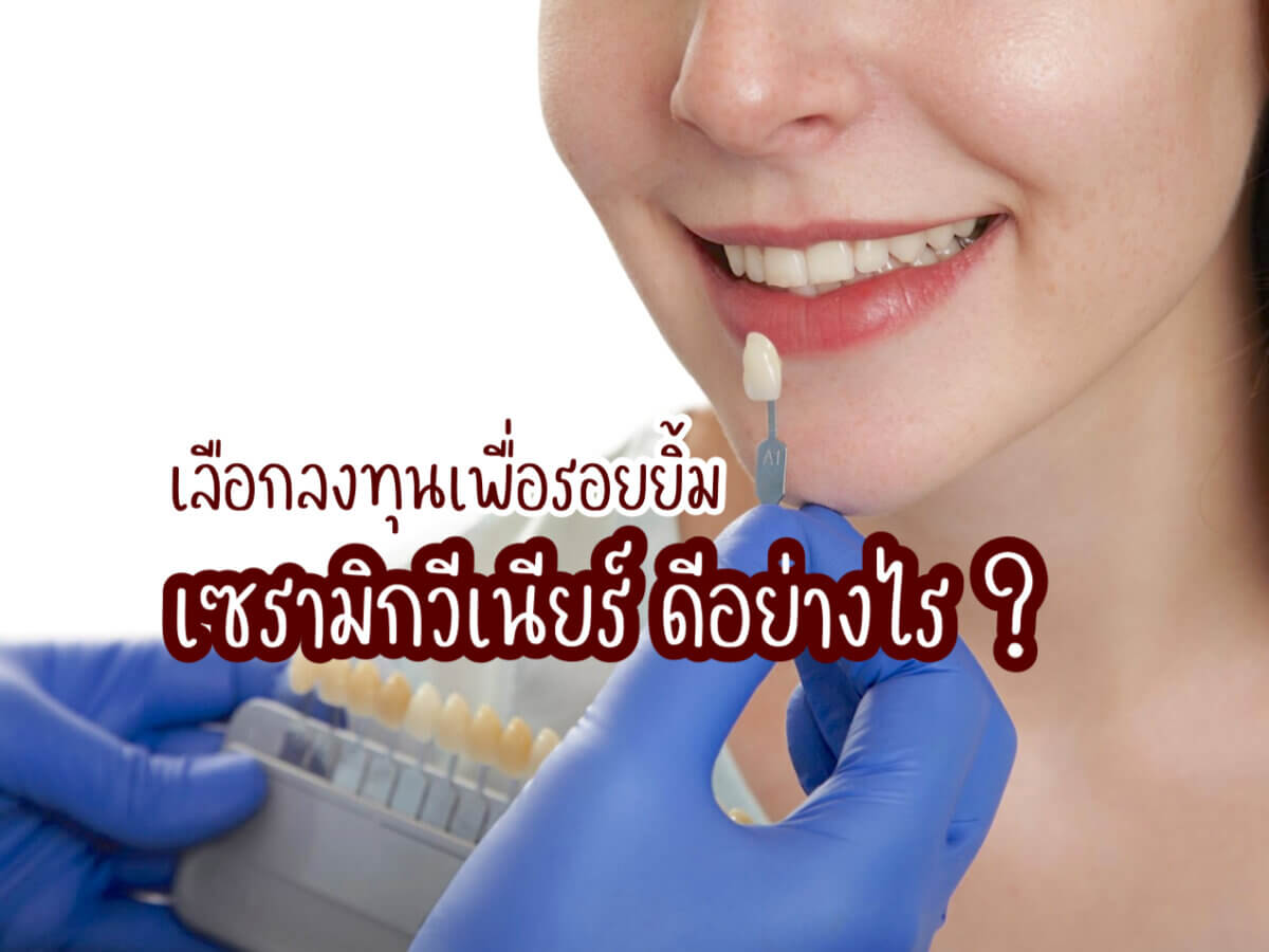 วีเนียร์