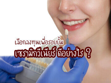 วีเนียร์