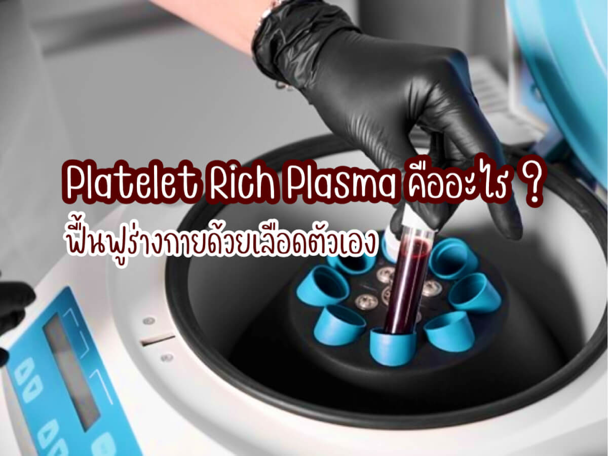 Platelet Rich Plasma
