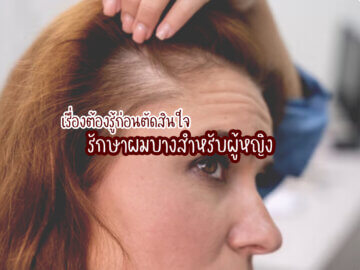 รักษาผมบางสำหรับผู้หญิง