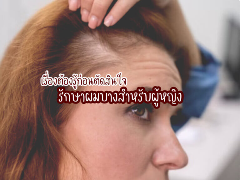 รักษาผมบางสำหรับผู้หญิง