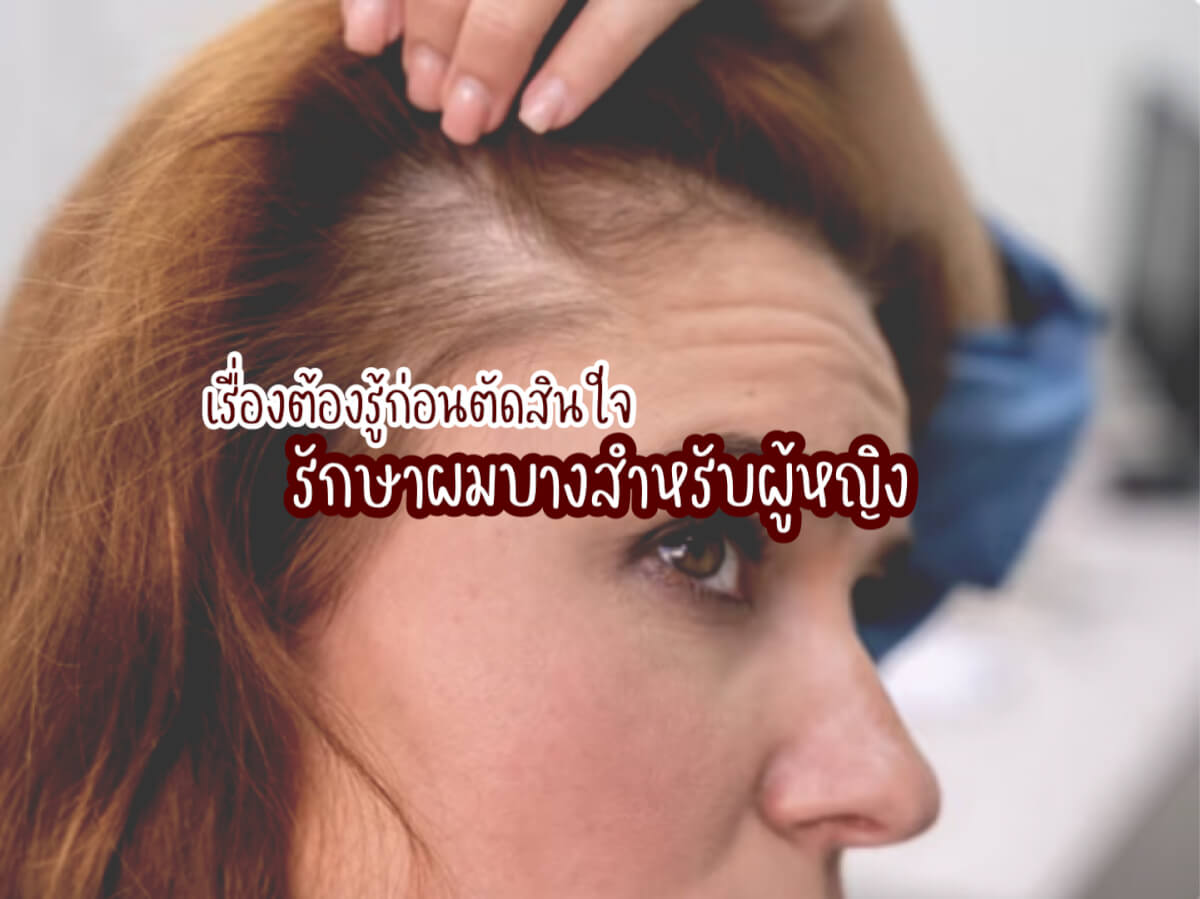 รักษาผมบางสำหรับผู้หญิง